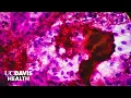 New Blood Test for Tuberculosis Could Transform Global TB Diagnosis UC Davis Health Research