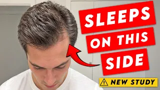 Does sleeping on your side lead to hair loss New Research
