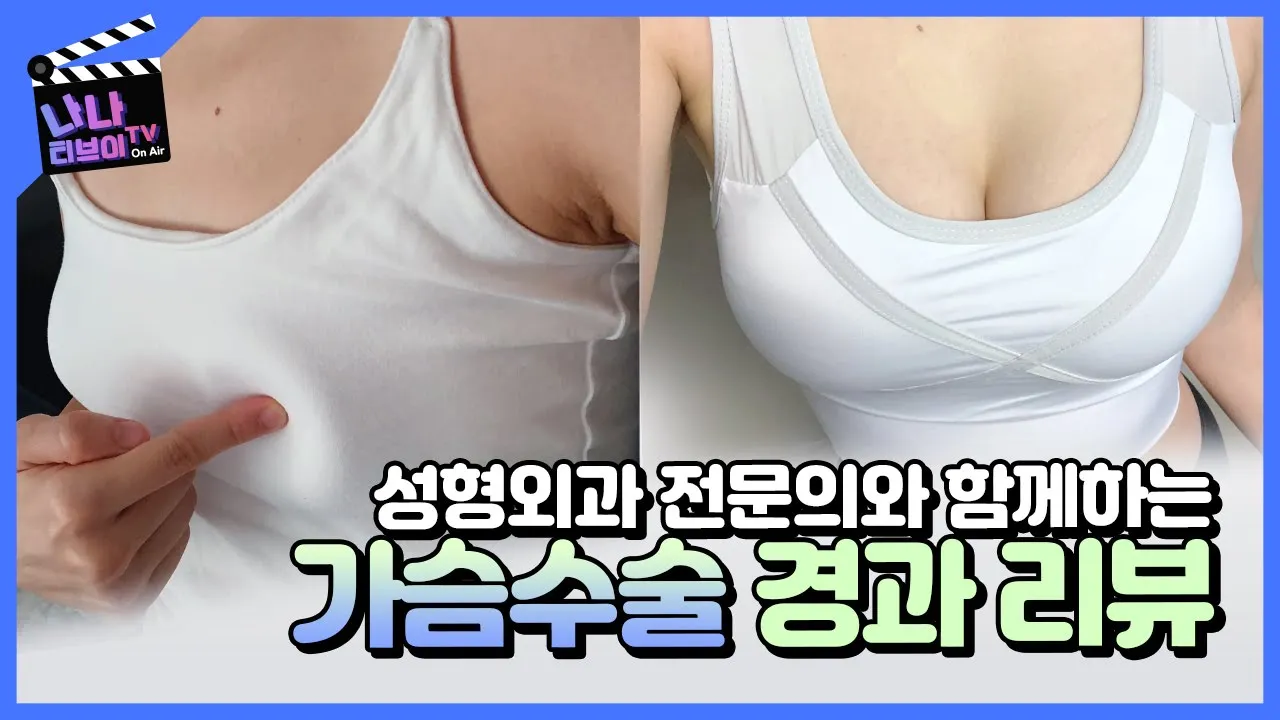 [가슴수술 1년 ] 성형외과 전문의가 1년 가슴성형 경과, 증상에 대해서 자세히 알려드립니다(feat. 가슴촉감 흉터 이렇게 생생히 알려준다고?)