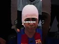 The real reason Lamine Yamal always hides his forehead