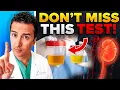 THIS Test That Can Save A Diabetic s Life