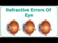 Refractive errors of eye Ophthalmology lectures