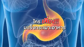 ใครมีความเสี่ยงต่อการเป็นมะเร็งกระเพาะอาหารบ้าง