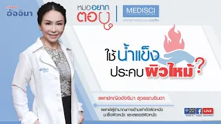 การประคบก้อนน้ำแข็งบนผิวที่ไหม้แดดช่วยบรรเทาอาการได้หรือไม่