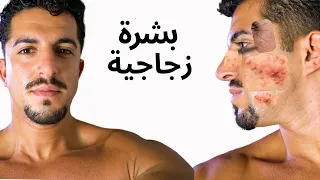 كيف تحصل على بشرة زجاجية 