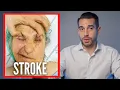 Biggest RISK Factor For STROKE