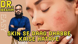 Download Skin Se DAAG DHABBE Kaise Hataye | How to Remove Blackheads, Scars \u0026 Blemishes | Dr. M. Ibrahim MP3