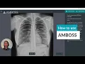 How to use AMBOSS for MD Students Unlocking Success in In-House Exams and Step 1