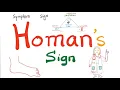 Homans Sign - Deep Vein Thrombosis DVT