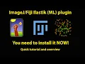 Ilastik plugin for