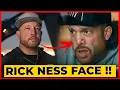 What Happened to Rick Ness Face SHOCKING UPDATES