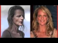 Helen Hunt Plastic Surgery Before and After Photos