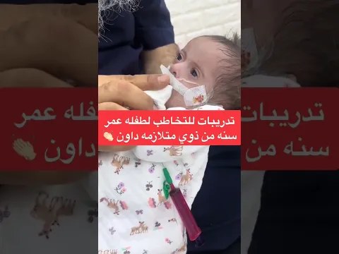 قلوب تنبض بالأمل: تدريبات النطق والتخاطب لطفل رضيع من ذوي متلازمة داون وسط التحديات الصحية الحرجة.