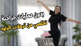 تمارين شد الزنود بسرعة بديل العمليات الجراحية 