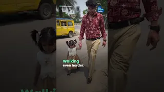 He Lost Both Legs at 13. Then Achieved the Impossible. thumbnail