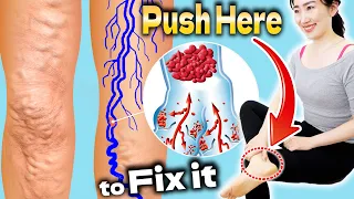 Download Push Here for 3 Minutes to Remove Swelling \u0026 Prevent Varicose Veins and Slim Legs MP3