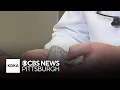 How 3D printing at UPMC makes jaw in a day surgery possible