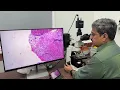Image J Processing Images - Subtraction