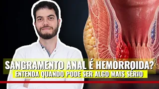 Fístula Anal Pode Sangrar? Entenda Por Que Isso Acontece