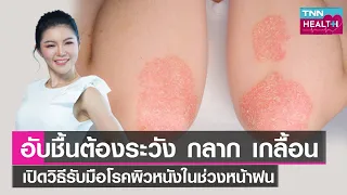 โรคผิวหนังที่เกิดจากเชื้อราในช่วงหน้าฝนมีอะไรบ้าง และเกิดจากสาเหตุใด