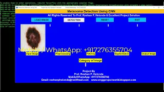 Skin Cancer Detection Using Python Opencv Skin Lesion Prediction Using Deep Learning CNN
