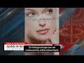 Eyelid Rejuvenation and Aging In Reverse - Liz Bonis
