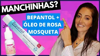 BEPANTOL+ÓLEO DE ROSA MOSQUETA CLAREIA MANCHAS? MELASMAS? A Verdade Sobre o óleo de Rosa Mosqueta