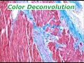 Separating colors in light microscopy images Color Deconvolution in