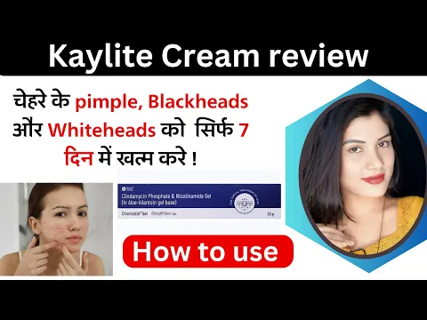 Download MP3 Clinmiskin Gel Uses in Hindi | Clindamycin Phosphate \u0026 Nicotinamide Gel | how To Use | Side Effects