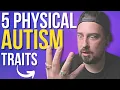 How to Identify AUTISM Easily 5 SIMPLE PHYSICAL SIGNS