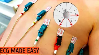 how to do ecg on patient ecg made easy ecg tutorial drtusarofficial