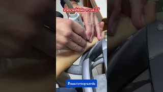 ก้อนที่เกิดขึ้นบนฝ่ามือมีสาเหตุมาจากอะไร และมันคือสิ่งที่อันตรายหรือไม่