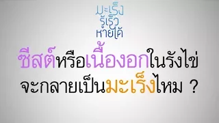 ถุงน้ำที่รังไข่มีกี่แบบ และแต่ละแบบมีความเสี่ยงต่อมะเร็งอย่างไร