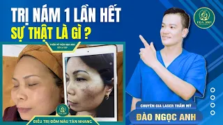 Nám da có thể hết sau 1 lần laser? Chuyên gia giải mã! | Đào Ngọc Anh { Thẩm Mỹ }
