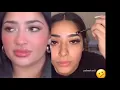 Karizma Rivera hija de Lupillo Rivera con demasiado botox y relleno