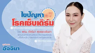 โรคเซ็บเดิมคืออะไร และมีอาการอย่างไรบ้าง