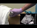 Download Lagu ABDOMINAL ULTRASOUND SCANNING PROTOCOL AND APPROACHES.