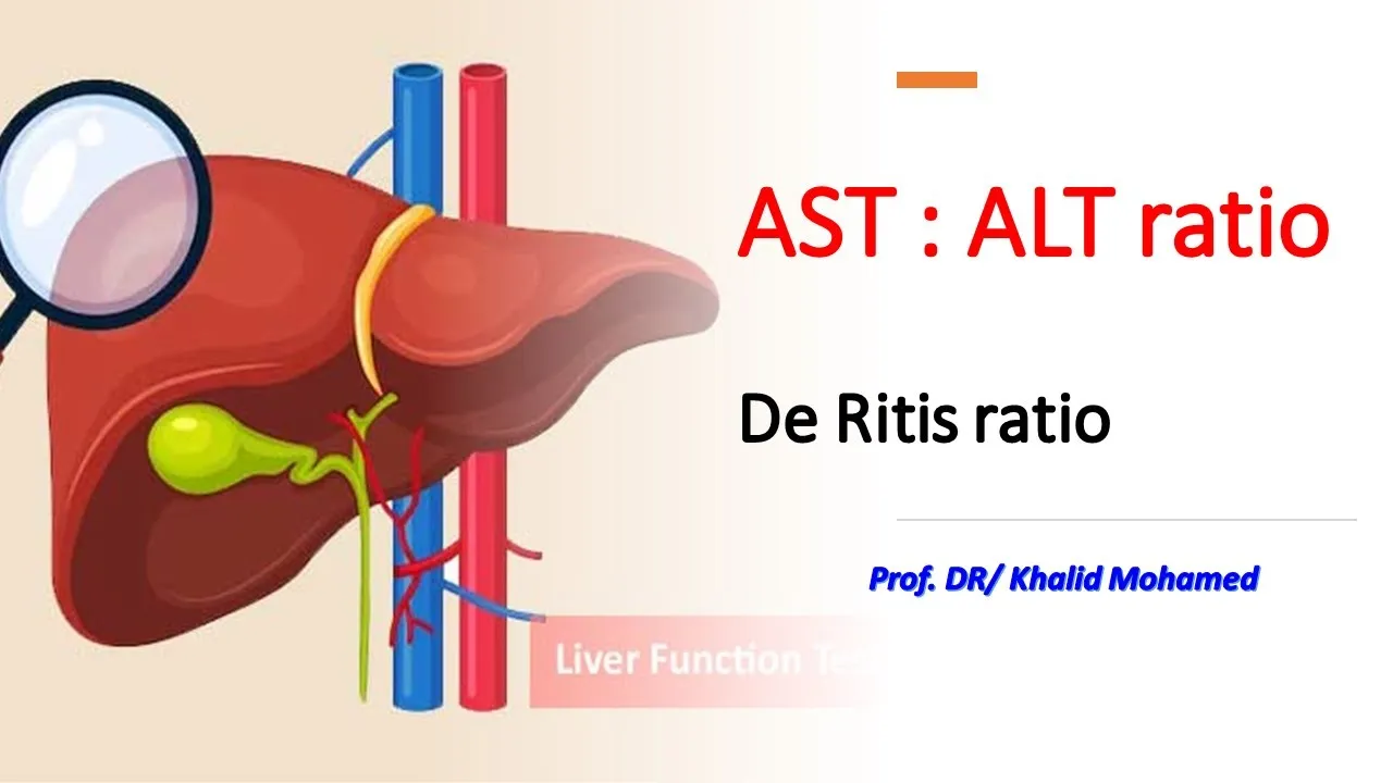 AST : ALT. De Ritis ratio. #sgot #sgpt #hepatitis