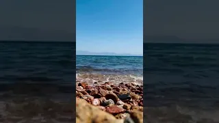 وانا زيك بردو و اكتر   حماقي دندنها