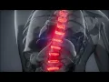 The Spinal Tapper by Sapien Medicine