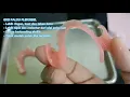 The differences between acrylic denture and flexible denture