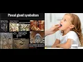 AD PINEAL GLAND DYSFUNCTION CONNECTION TROUBLE SLEEPING DEPRESSED CAN T FOCUS