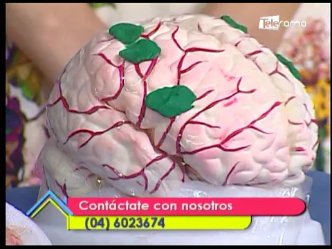 Causas del Alzheimer 