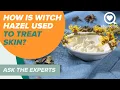 How is Witch Hazel Used to Treat Skin Ask The Experts Sharecare