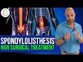 Spondylolisthesis Non Surgical Chiropractic Treatment