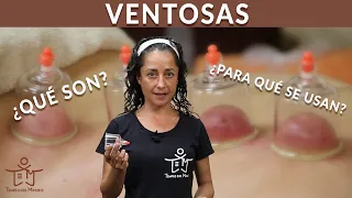 VENTOSAS || ¿Qué son? ¿Para qué se utilizan?