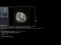 Combining IPython Julia Bioformats Java and Napari