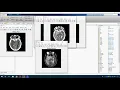 Medical Image Forgery Detection for Smart Healthcare in Matlab