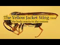 Download Lagu The Yellow Jacket Sting: How the body reacts to the venom