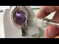 Demo of IUD Insertion with ASPIVIX R D